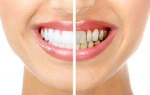 Periodoncia_en_Ciudad_Real Periodoncia_en_Ciudad_Real