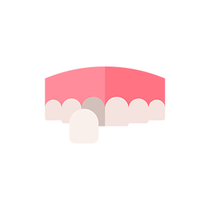 Estética dental en clinica dental IOM