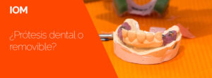 Lee más sobre el artículo Diferencias entre prótesis dental fija y removible
