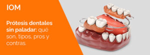 Lee más sobre el artículo Prótesis dentales sin paladar: Qué son, pros y contras