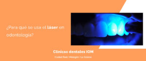 Lee más sobre el artículo ¿Para qué se usa el láser en odontología?