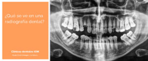 Lee más sobre el artículo ¿Qué se ve en una radiografía dental?