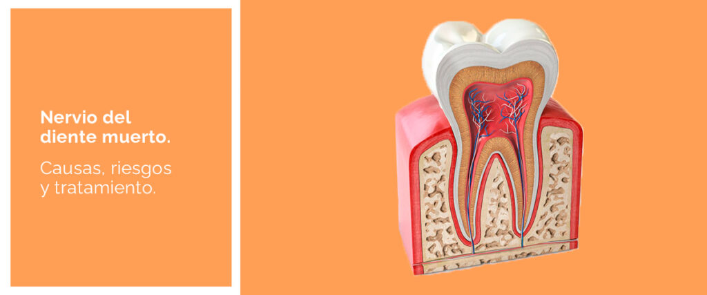 nervio-del-diente