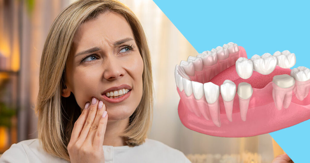 Dolor puente dental fijo